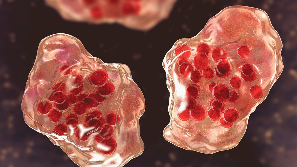 Central Minnesota county reports "several cases of suspected measles" — WCCO / CBS Minnesota, Stillwater Health news