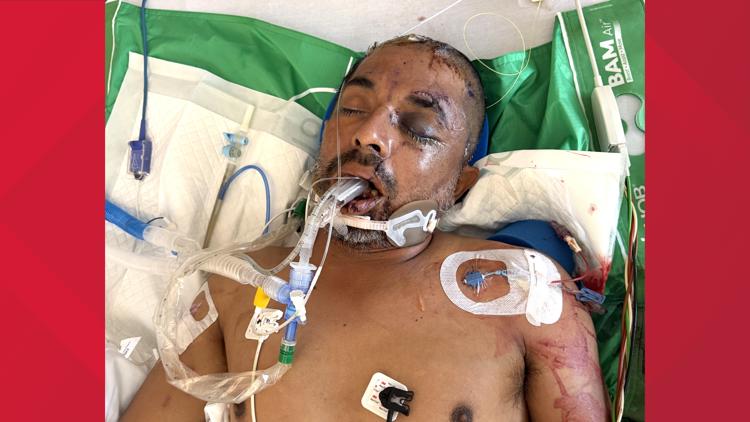 University Hospital asks for help identifying unconscious patient hit by truck Saturday evening — KENS 5 (San Antonio), Stillwater Health news